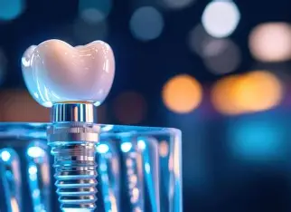 implant alırken nelere dikkat edilmeli